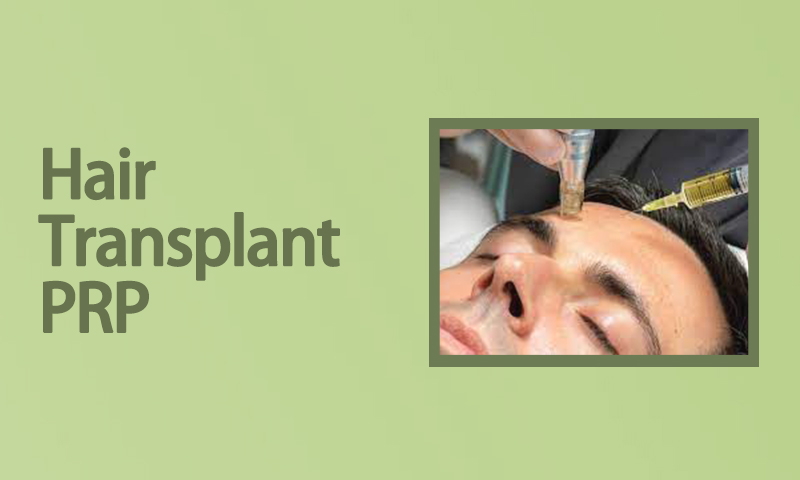 Hair Transplant - PRP