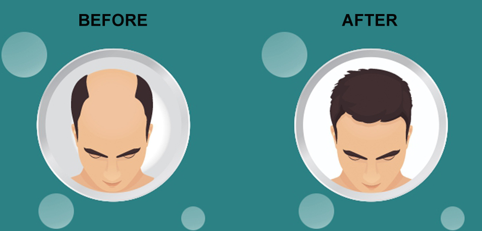 Investigation For Hair Loss