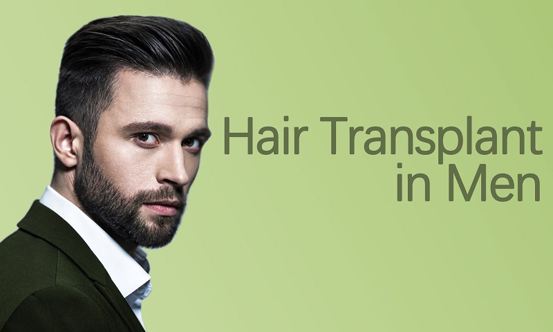 Best Hair Transplant for Men in Surat, Gujarat (India)