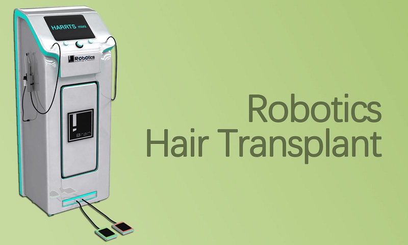 Robotics Hair Transplant