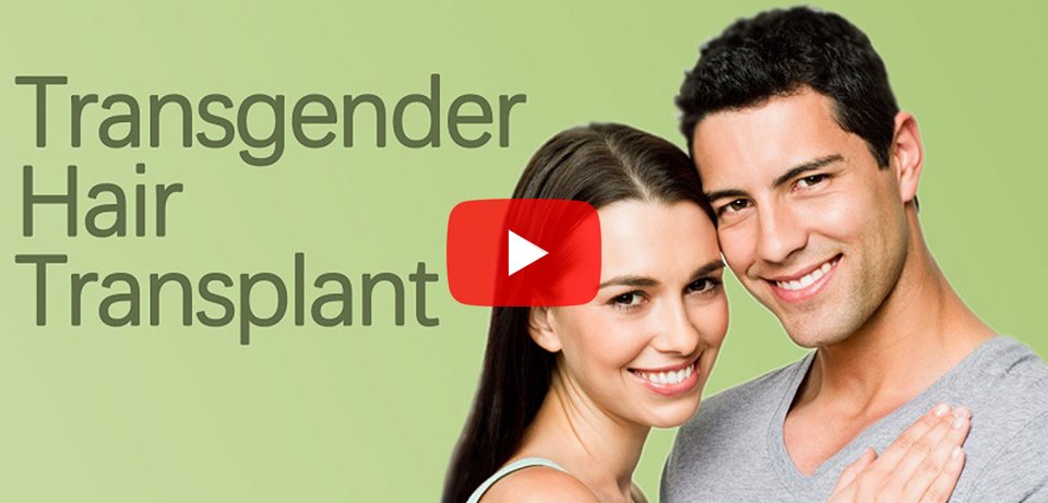 Transgender Hair Transplant Surgery in Surat, Gujarat (India)