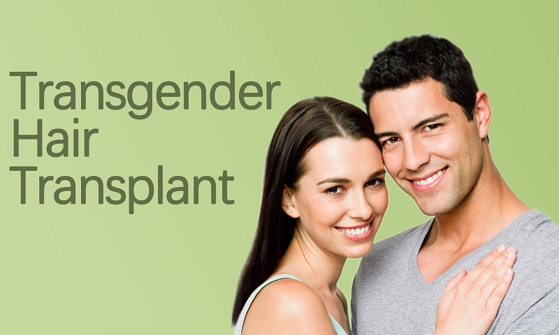 Transgender Hair Transplant Surgery in Surat, Gujarat (India)