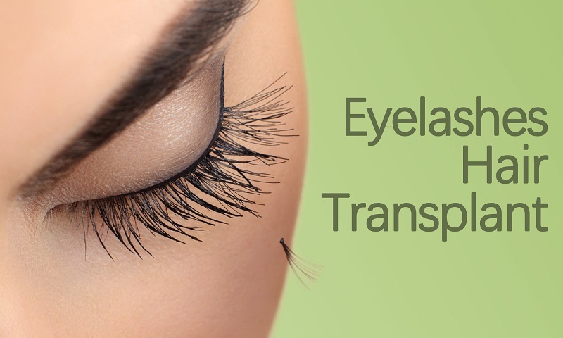 Eyelashes Hair Transplant in Surat, Gujarat (India)