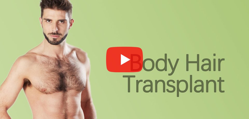 Body Hair Transplantation in Surat, Gujarat (India)