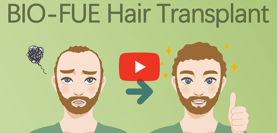 BIO-FUE Hair Transplantation