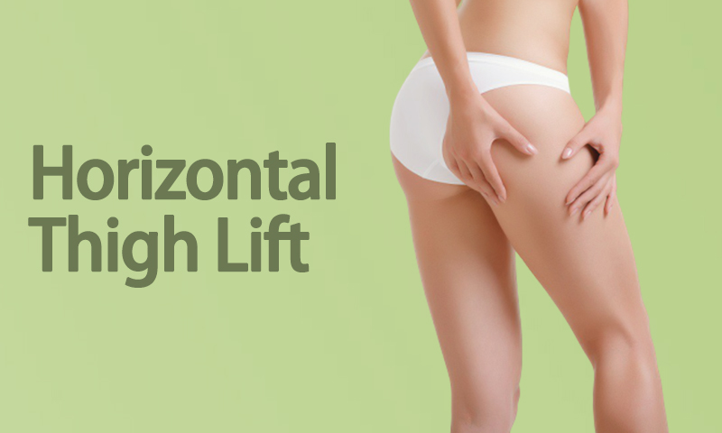 Horizontal Thigh Lift