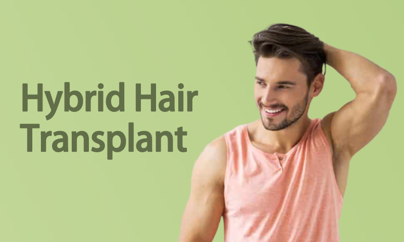 Hybrid Hair Transplant