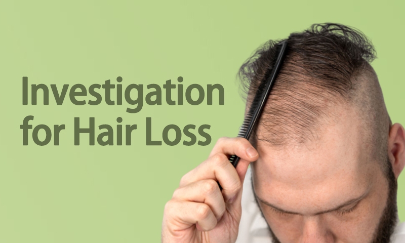 Investigation For Hair Loss