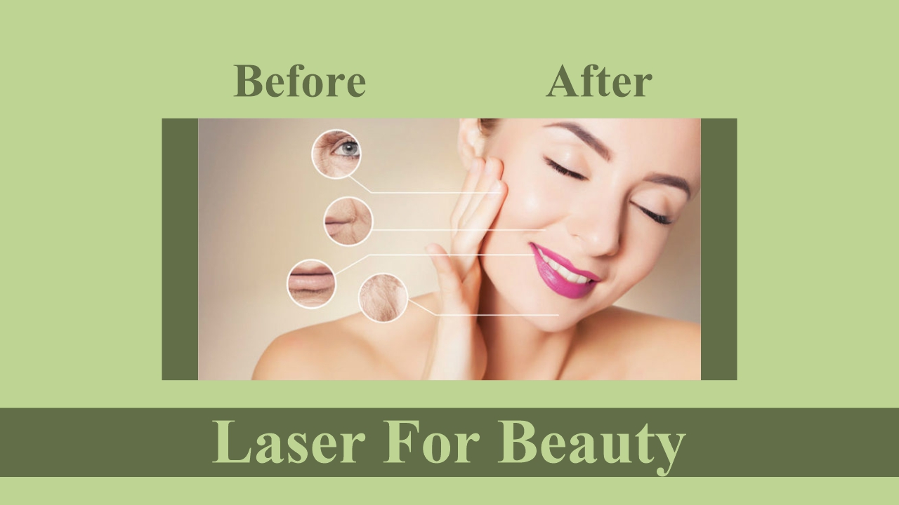 Laser for Acne Scar