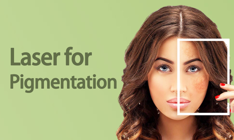 Laser for Pigmentation