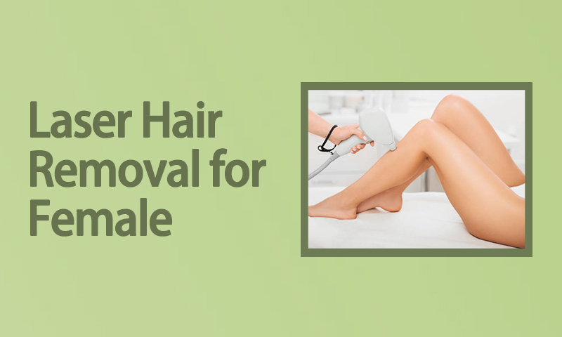 Laser Hair Removal for Female in Surat, Gujarat (India)