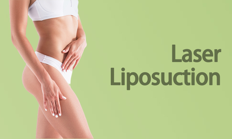 Laser Liposuction