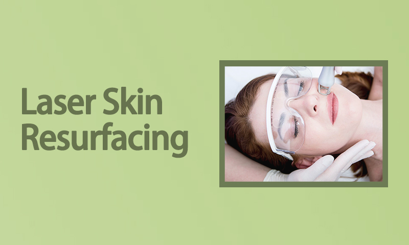 Laser Skin Resurfacing Treatment in Surat, Gujarat (India)