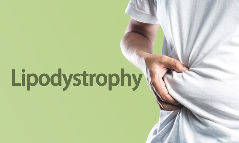 Lipodystrophy