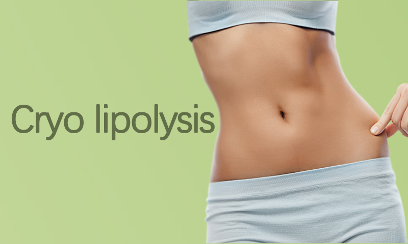 Cryo Lipolysis