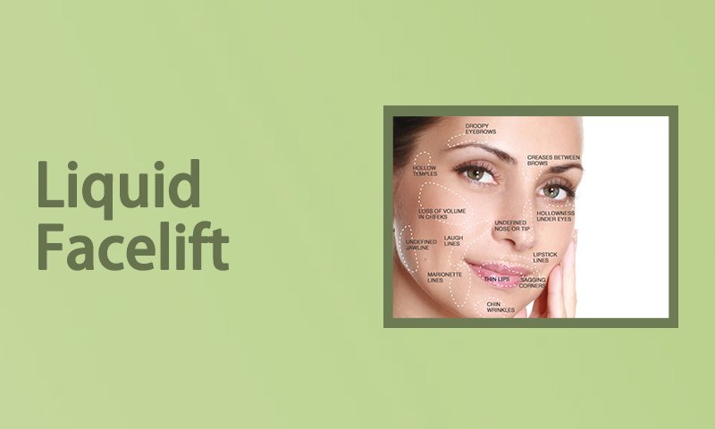 Liquid Facelift