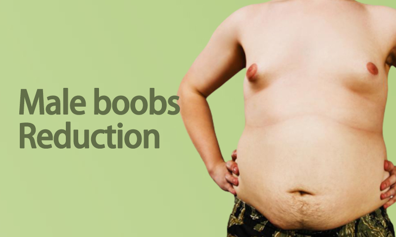 Male Boobs Reduction in Surat