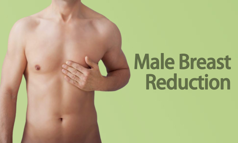 Male Breast Reduction in Surat