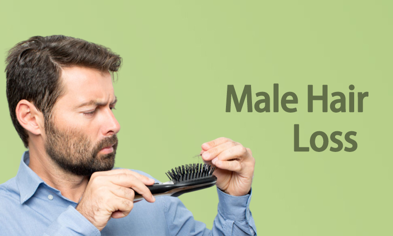 Male Hair Loss