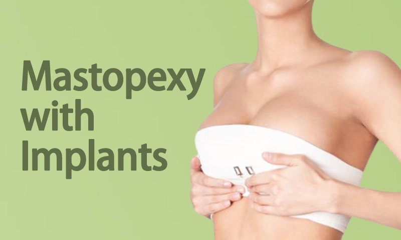 Mastopexy With Implants