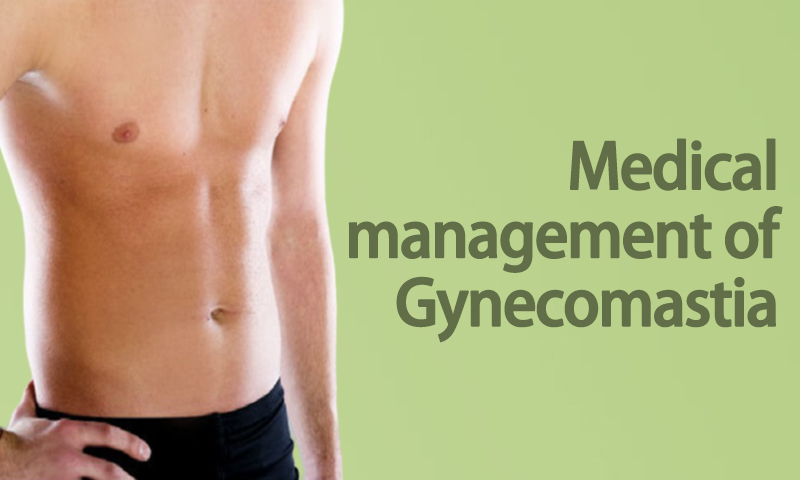 Medical Management Of Gynecomastia in Surat