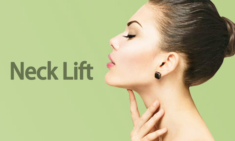 Neck Lift