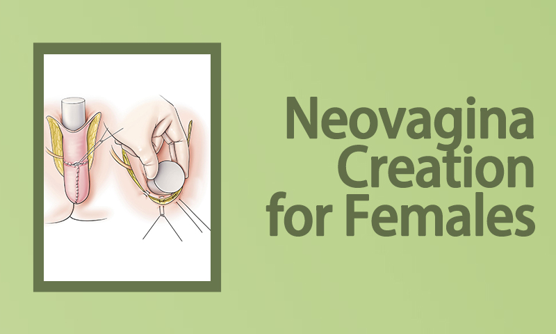 Neovagina Creation For Females