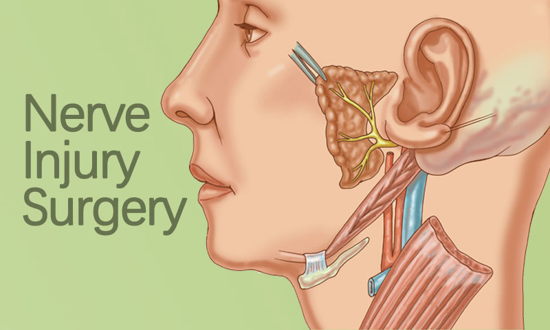 Nerve Injury Surgery in Surat, Gujarat (India)