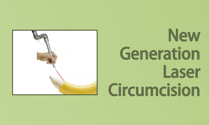 New Generation Laser Circumcision