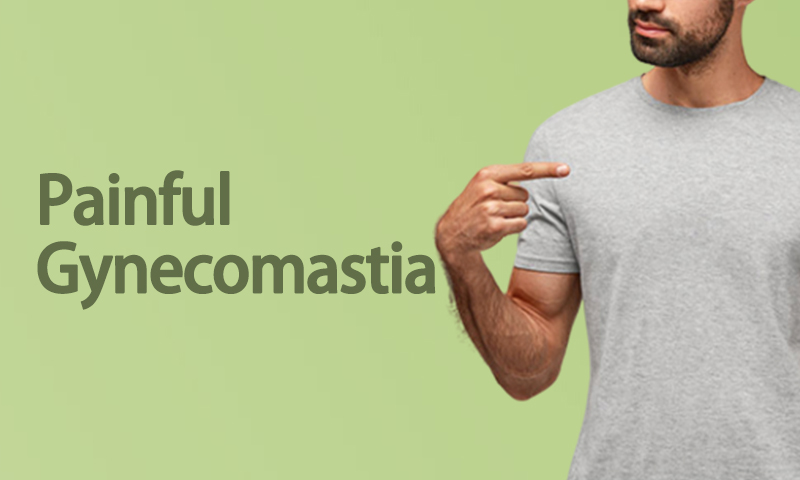 Painful Gynecomastia in Surat