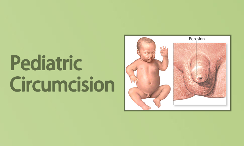 Pediatric Circumcision