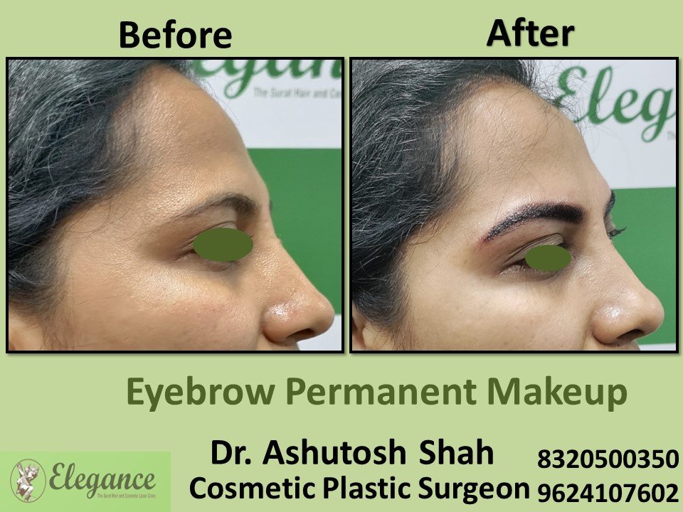 Permanent Eyebrows