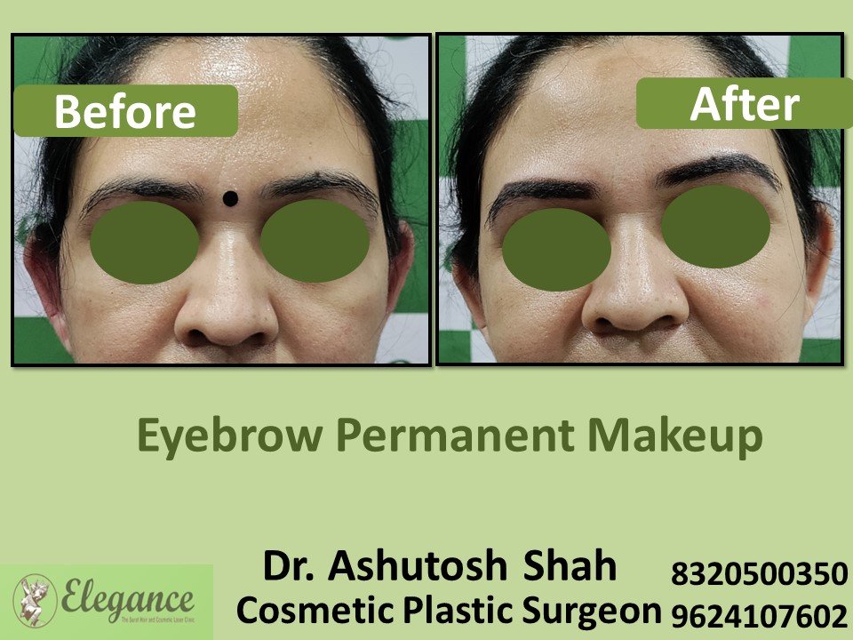 Permanent Eyebrows