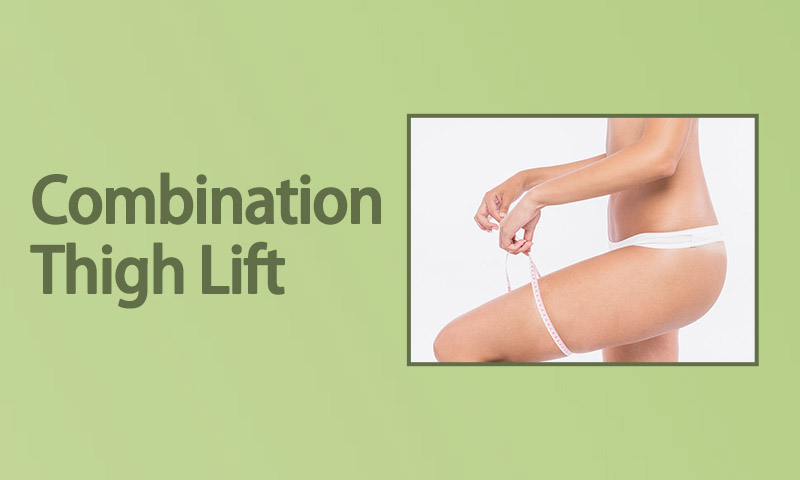 Combination Thigh Lift