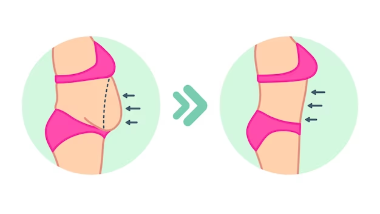 Lover Body Lift
