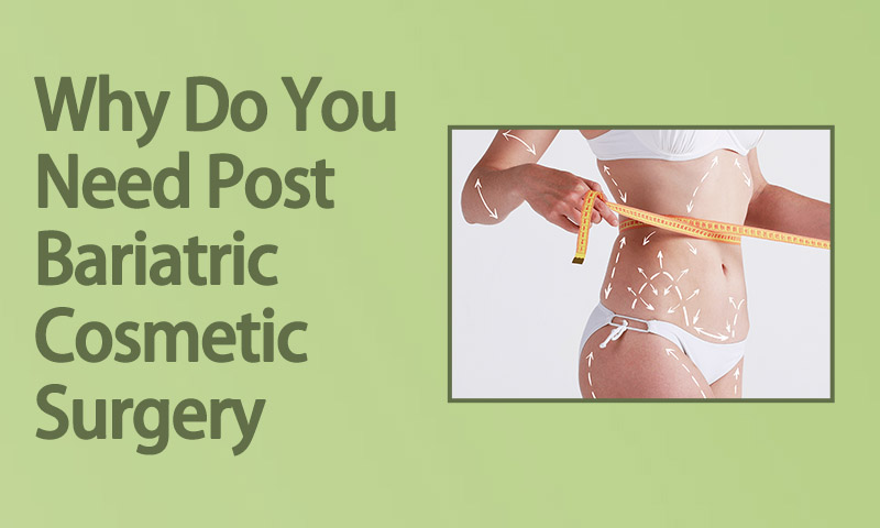 Why Do You Need Post Bariatric Cosmetic Surgery