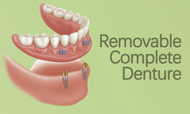 Removable Complete Denture in Surat, Gujarat (India)