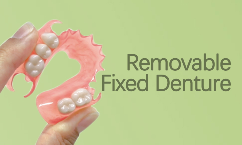 Removable Fixed Denture