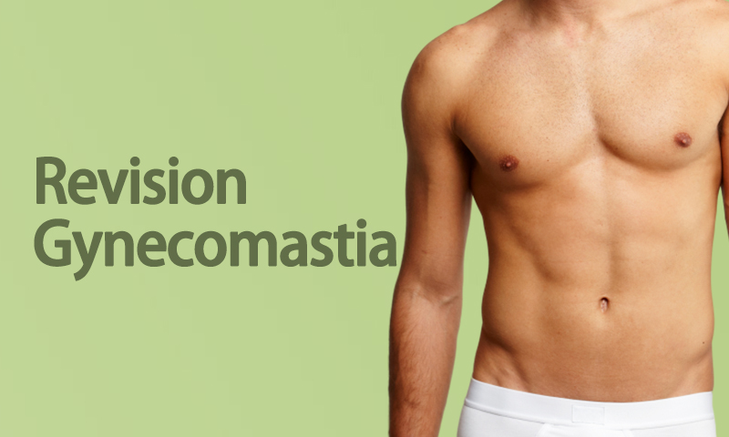 Revision Gynecomastia in Surat