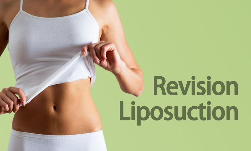 Revision Liposuction