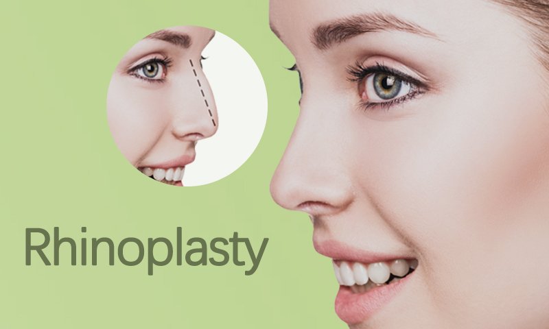 Rhinoplasty in Surat, Gujarat (India)