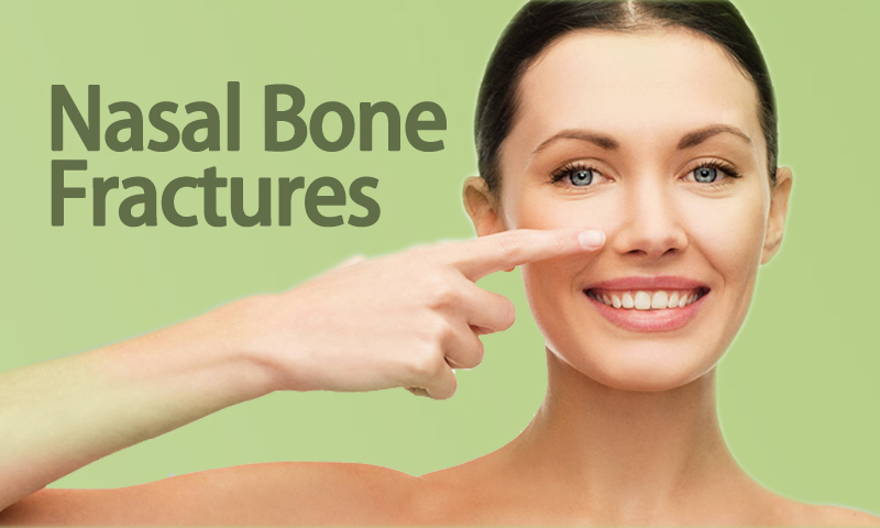 Nasal Bone Fractures