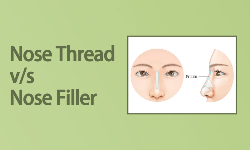 nose thread v/s nose filler