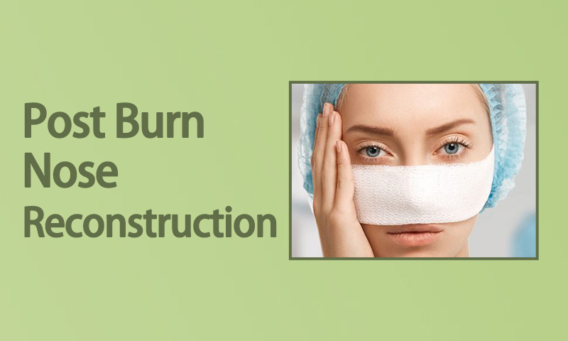 Post Burn Nose Reconstruction