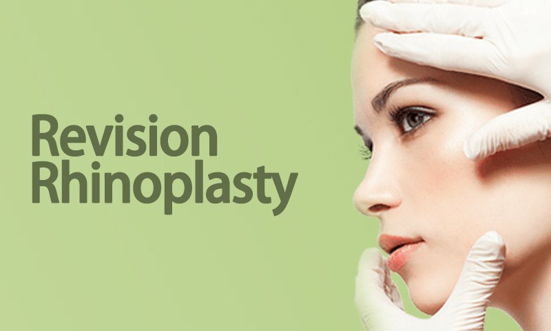 Revision Rhinoplasty