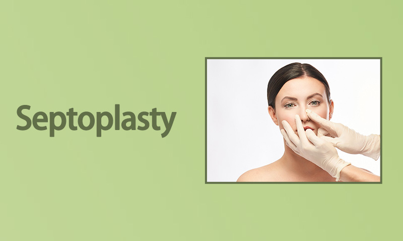 Septoplasty