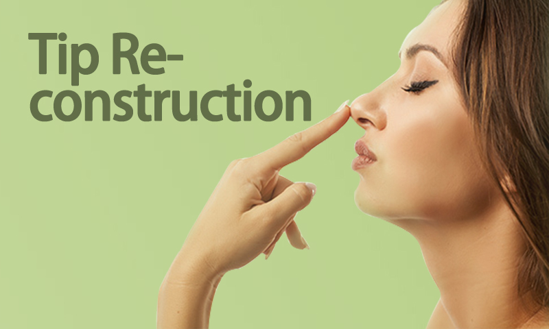 Tip Reconstruction