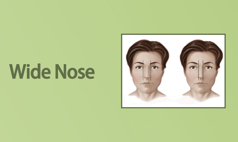 Wide Nose