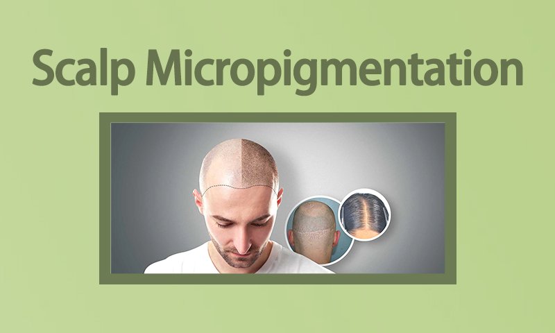 Scalp Micropigmentation