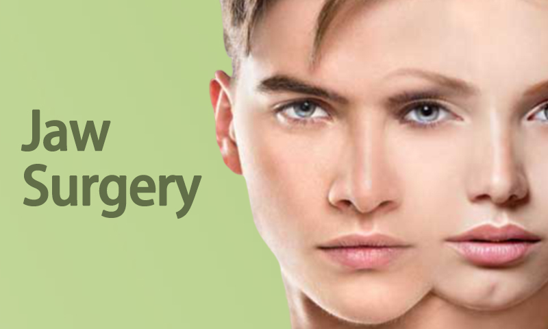 Jaw Surgery